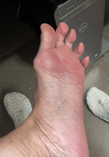 After treatment