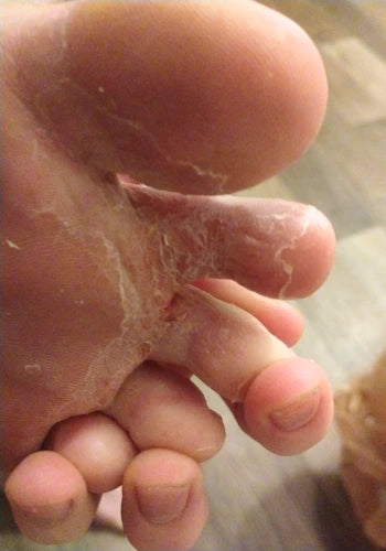 Before treatment