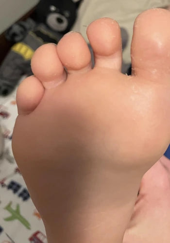After treatment