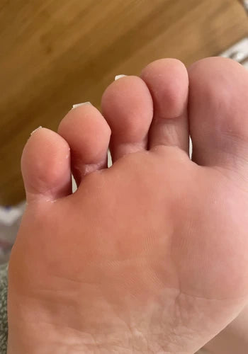 After treatment
