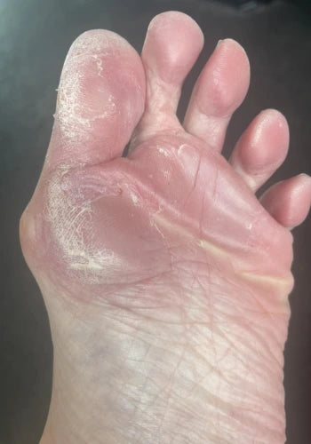 Before treatment