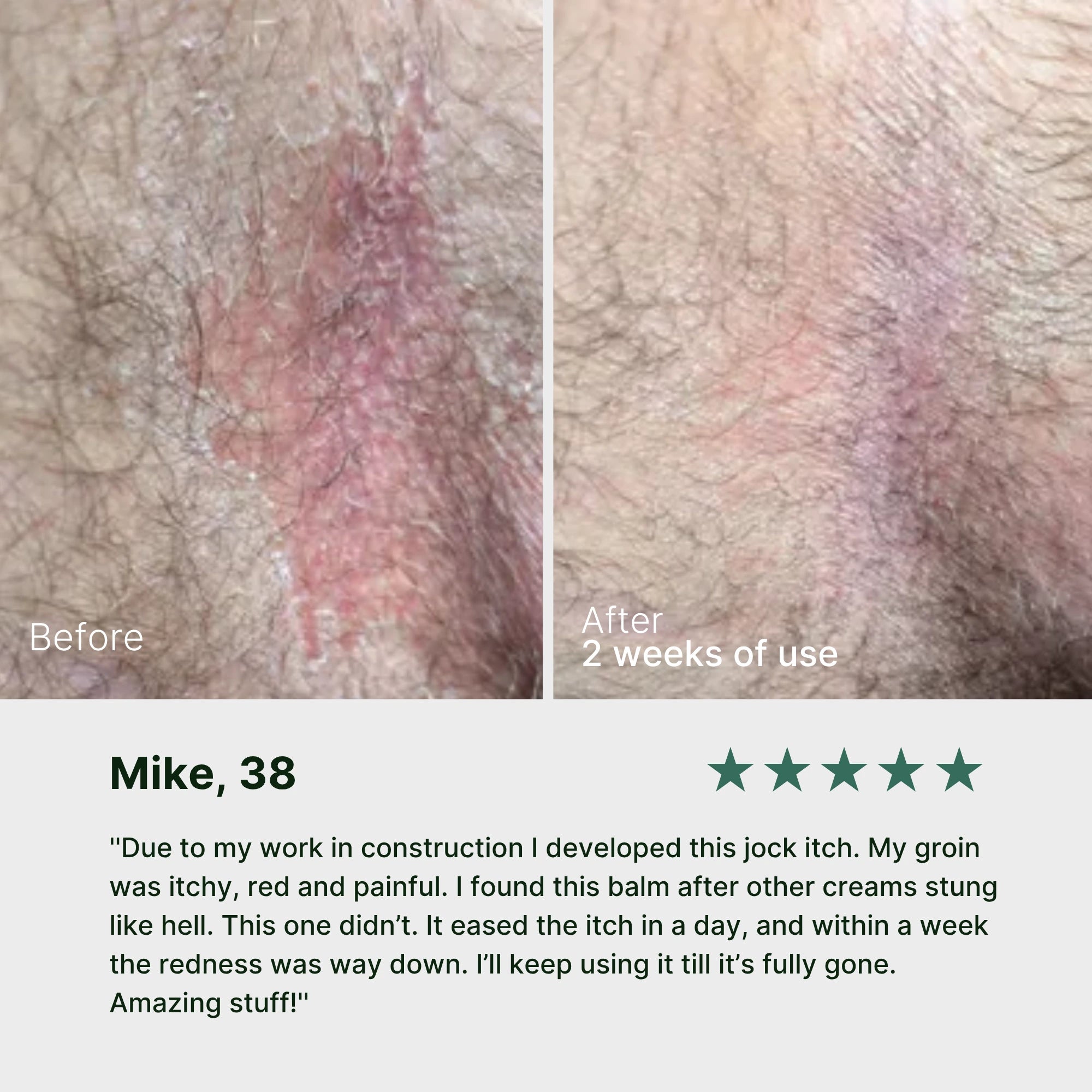 Easing Earth Anti-Fungal Balm